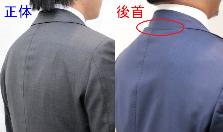 後首の方に出やすいシワ
